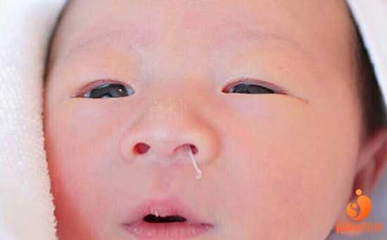 昆山代孕宝宝机构|【天津哪个医院可做供卵试管婴儿】今天是产后21天，宝宝现